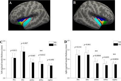 Region-Specific Changes of Insular Cortical Thickness in Heavy Smokers